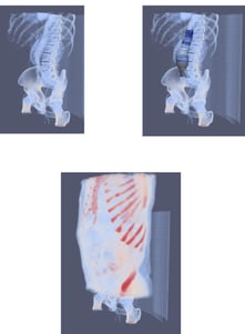 MMI Example